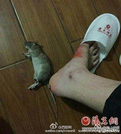 老鼠咬人的伤口图片,揭秘家中害虫留下的痕迹