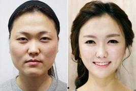 韩国整形外科,引领亚洲美容潮流的先锋力量