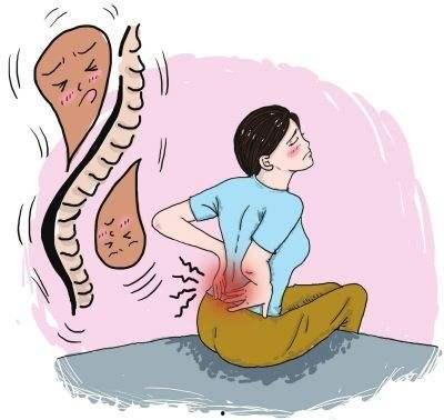 腰疼的图片大全,腰疼困扰？揭秘腰疼图片大全中的常见病因与防治策略