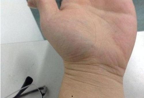 小拇指图片,小拇指的独特魅力