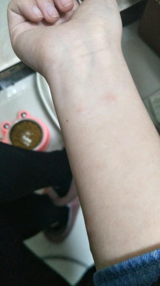 怀孕身上起红疙瘩图片