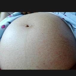 怀孕身上起红疙瘩图片